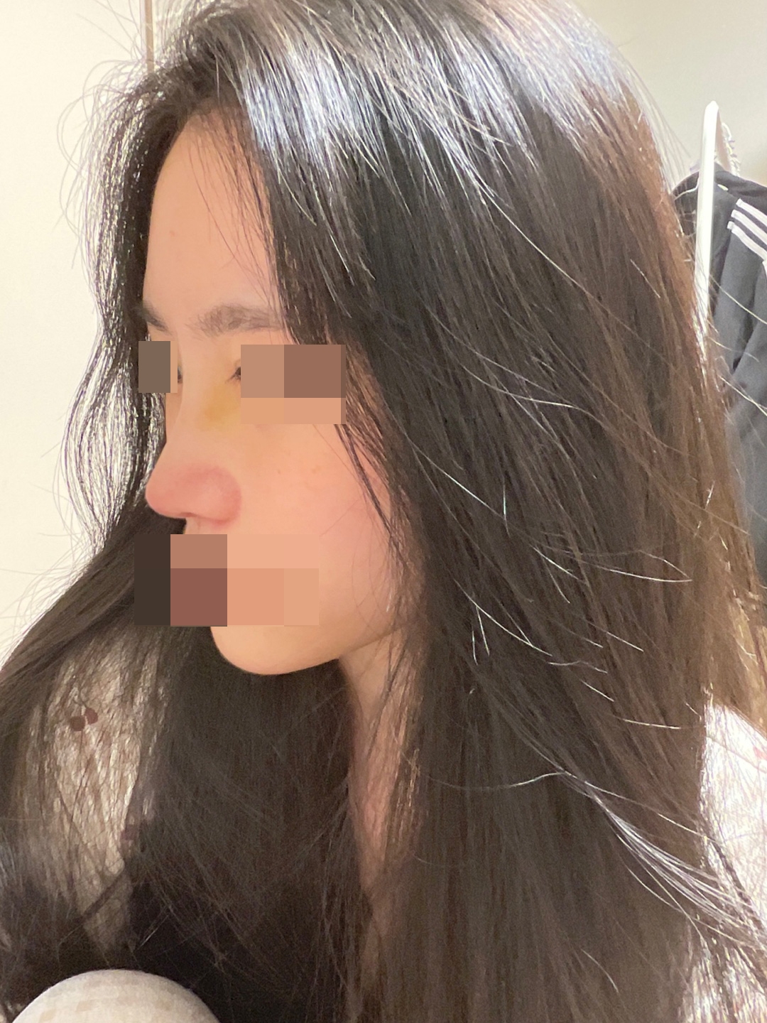 수술후기이미지