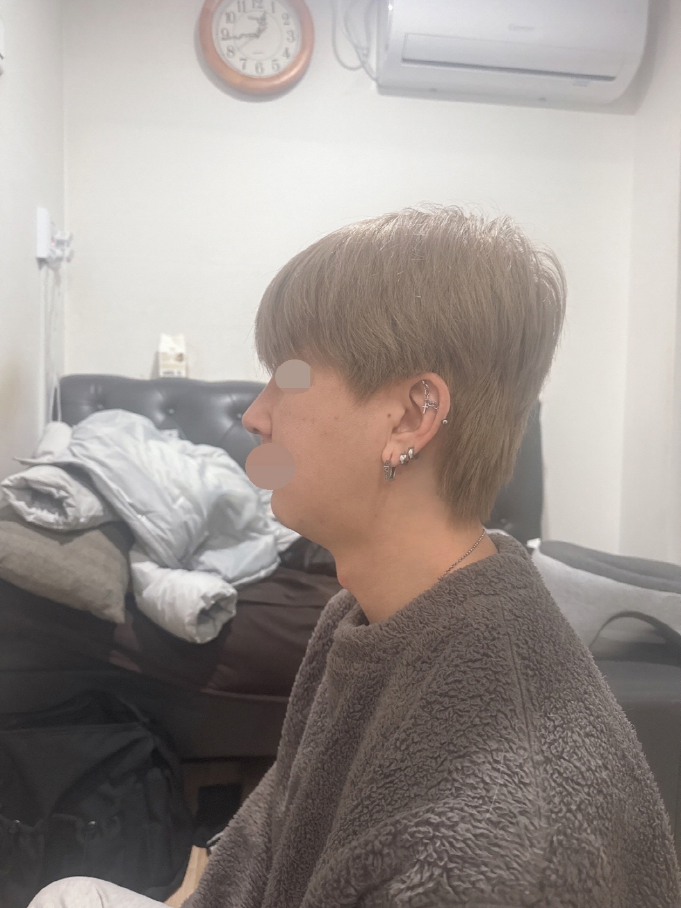 수술후기이미지