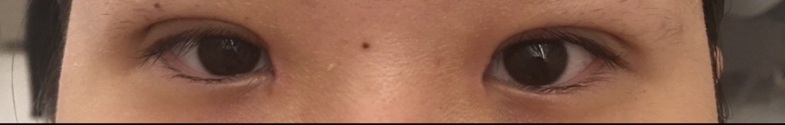 수술후기이미지