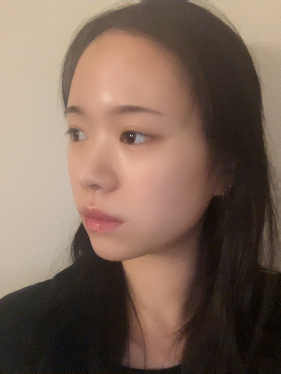 수술후기이미지