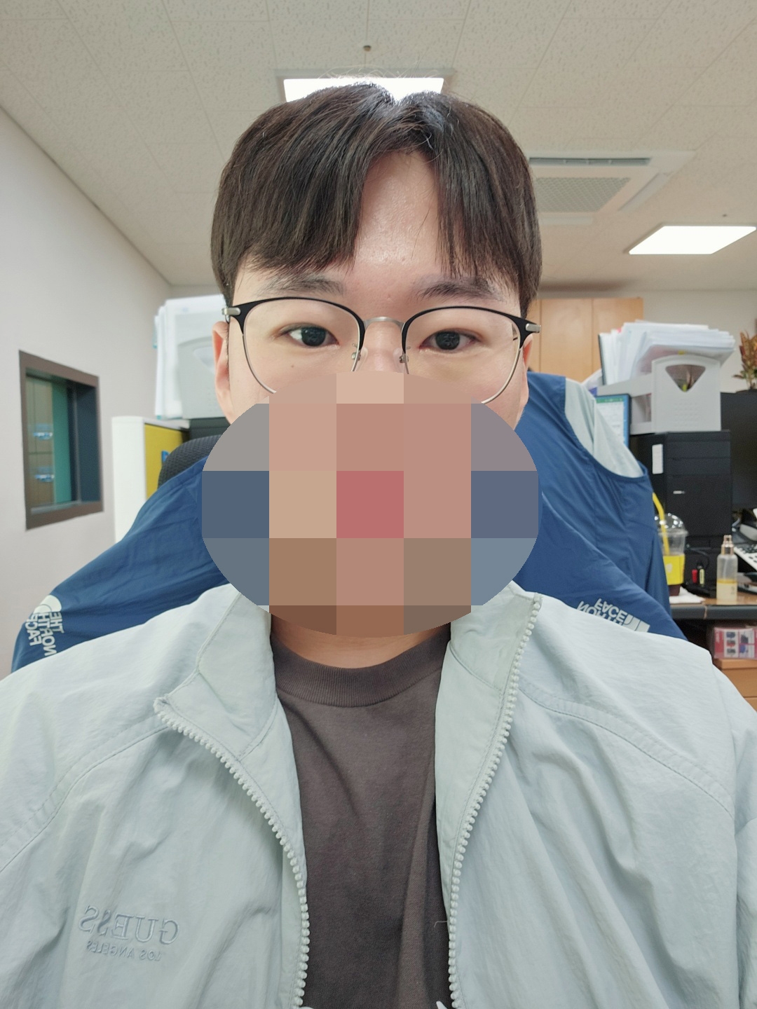 수술후기이미지