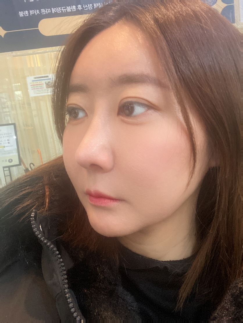 수술후기이미지