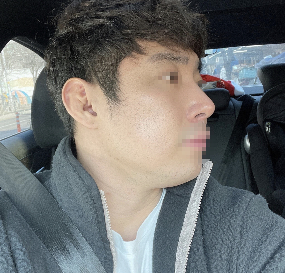 수술후기이미지