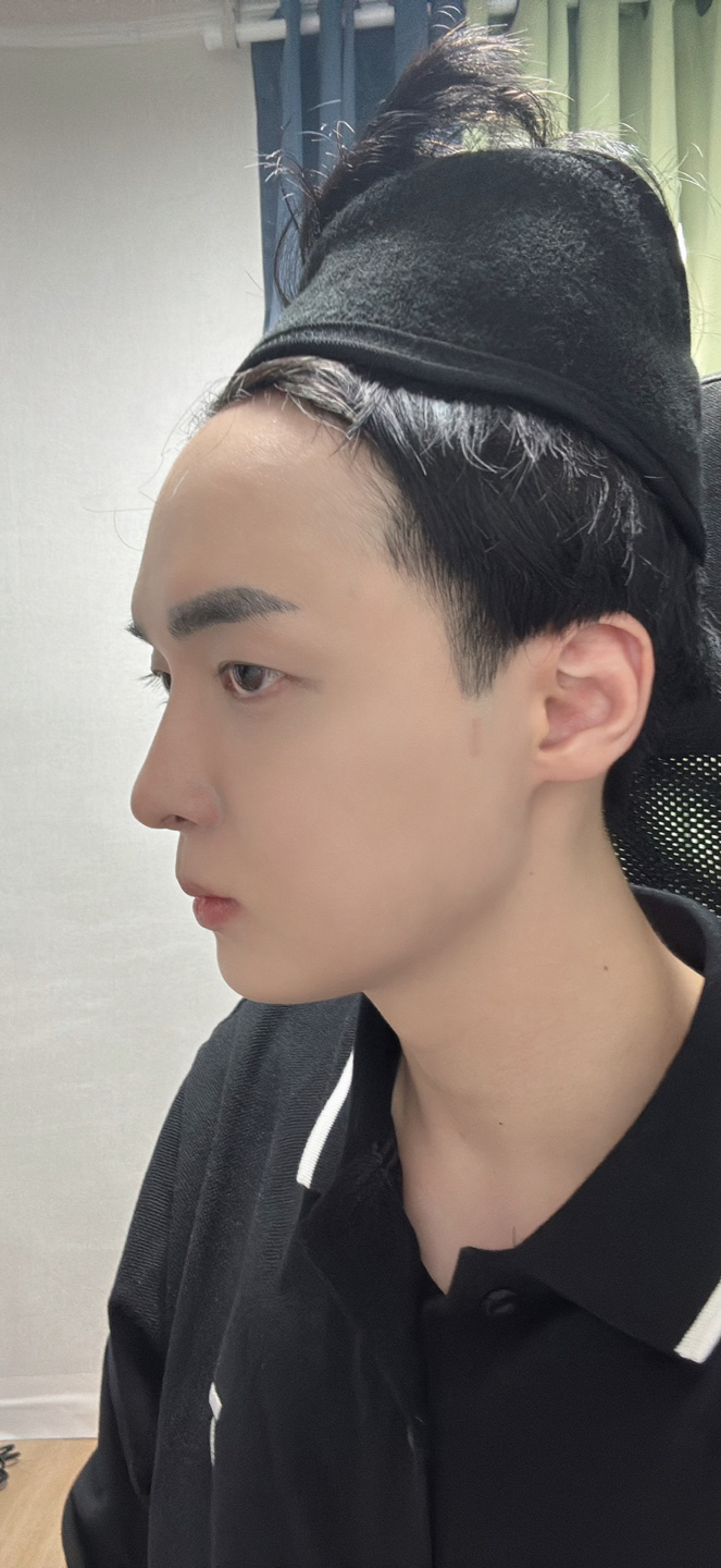 수술후기이미지