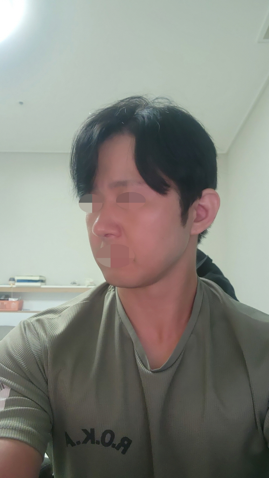 수술후기이미지