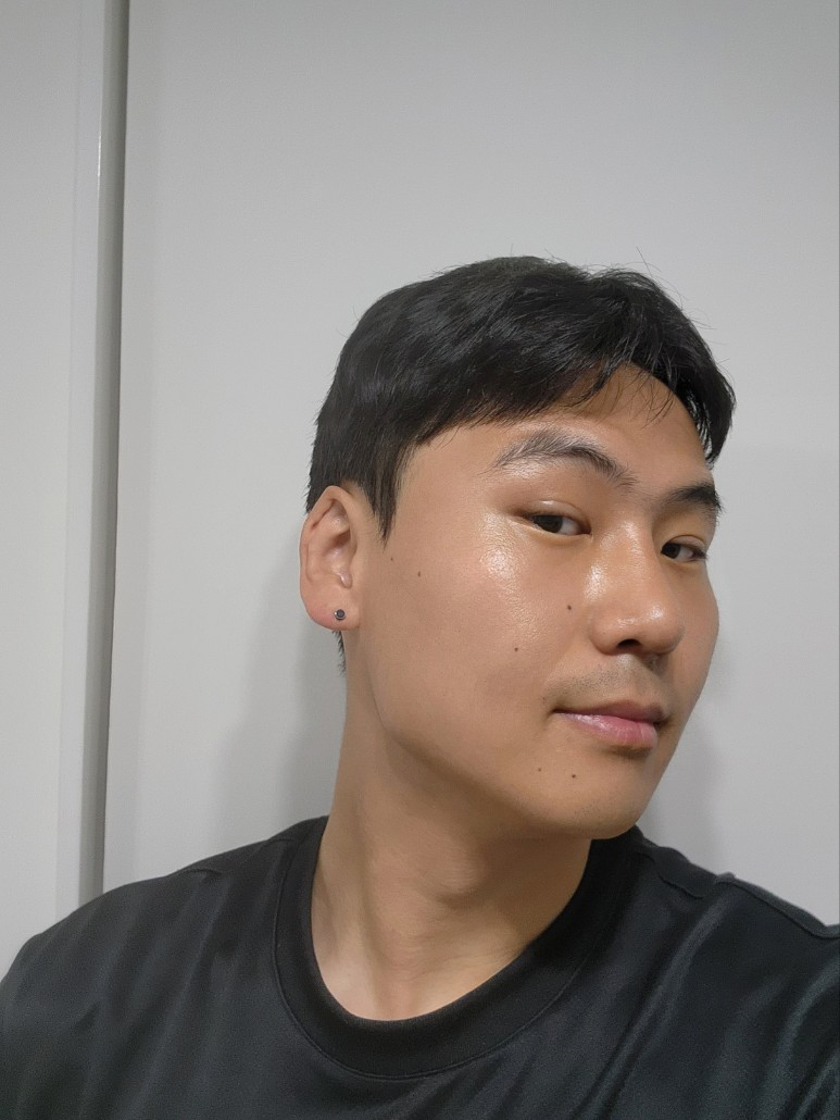 수술후기이미지