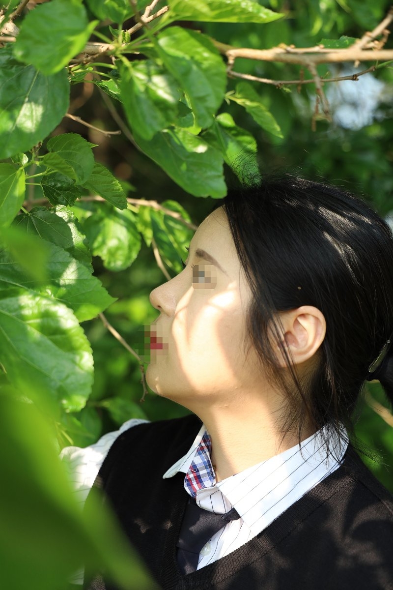 수술후기이미지