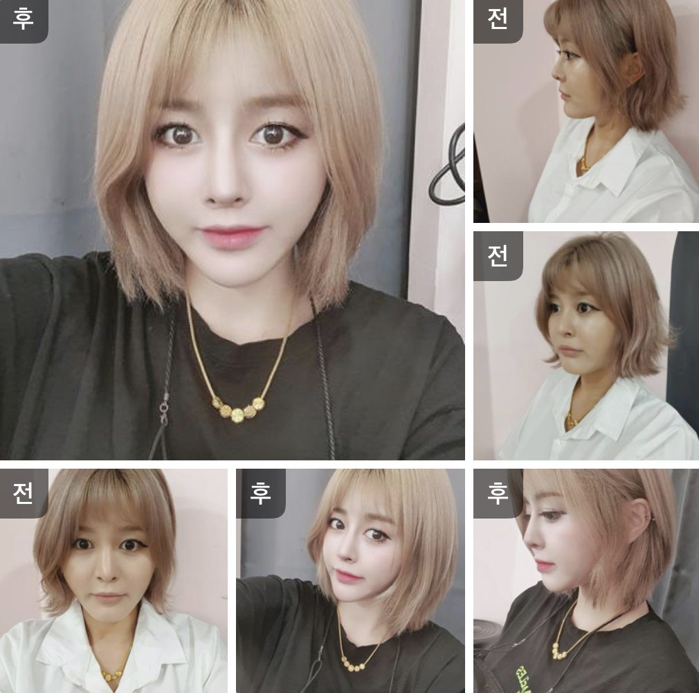 수술후기이미지