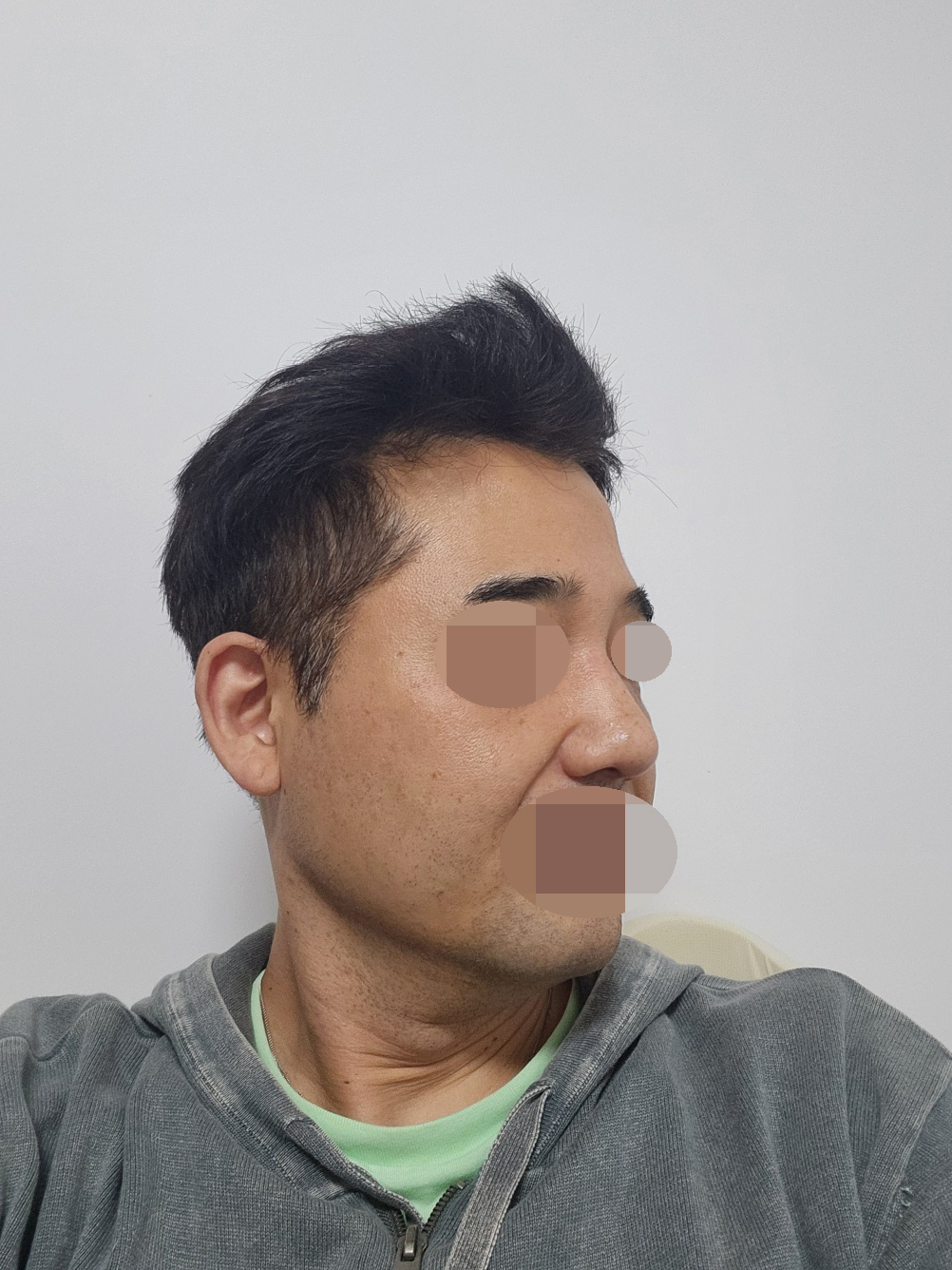 수술후기이미지