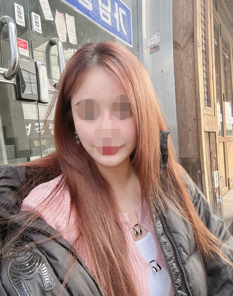 수술후기이미지