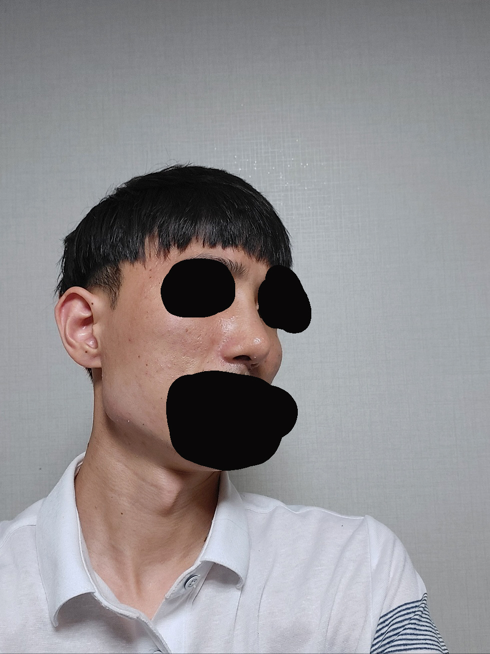 수술후기이미지