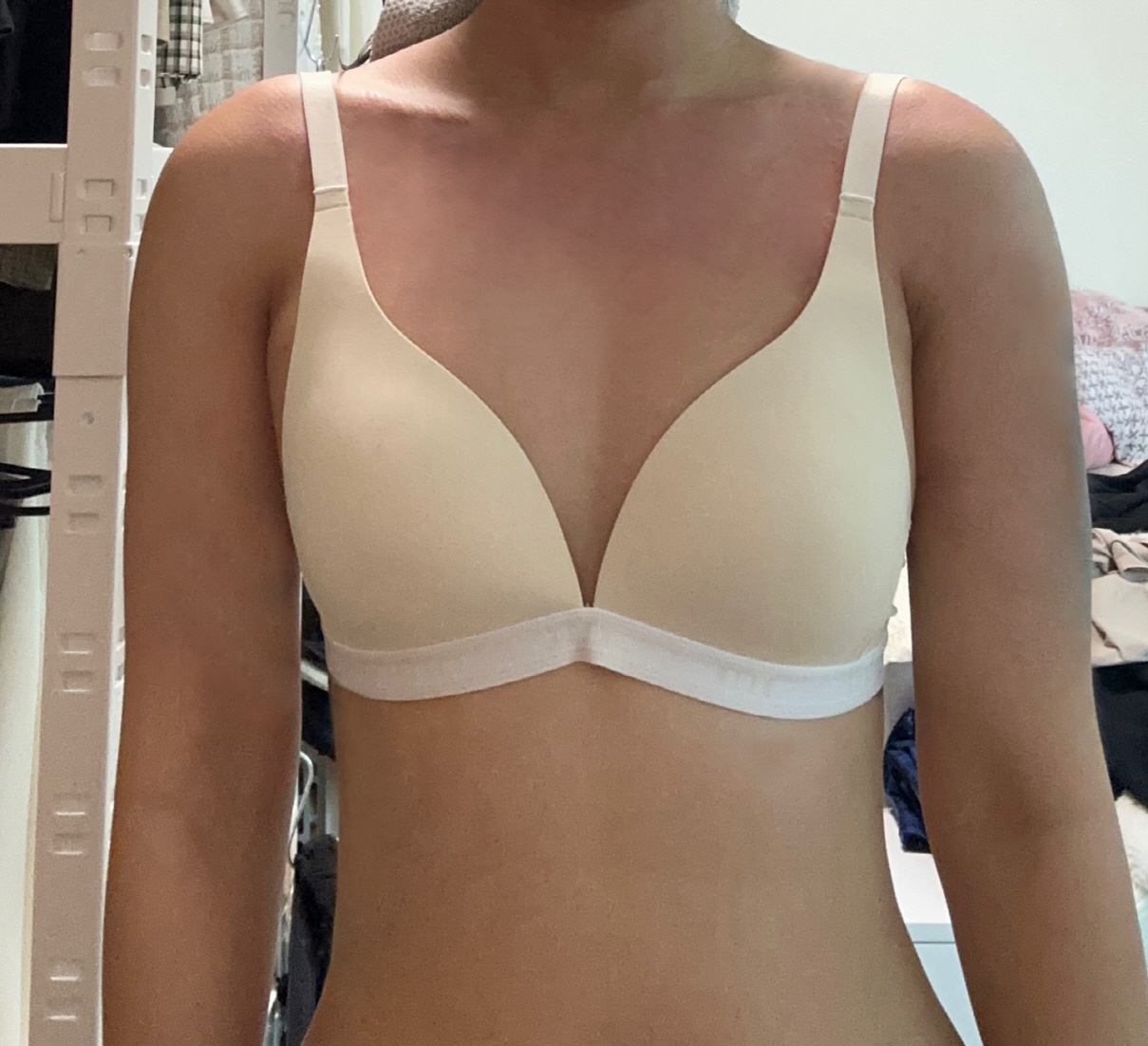 수술후기이미지