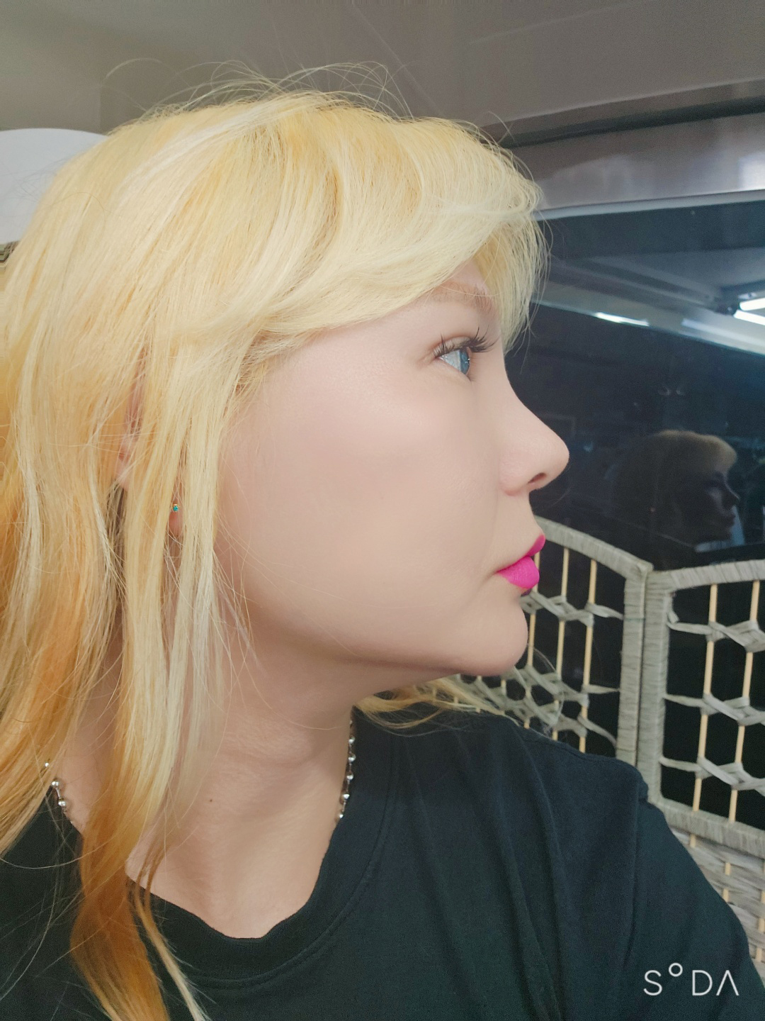 수술후기이미지