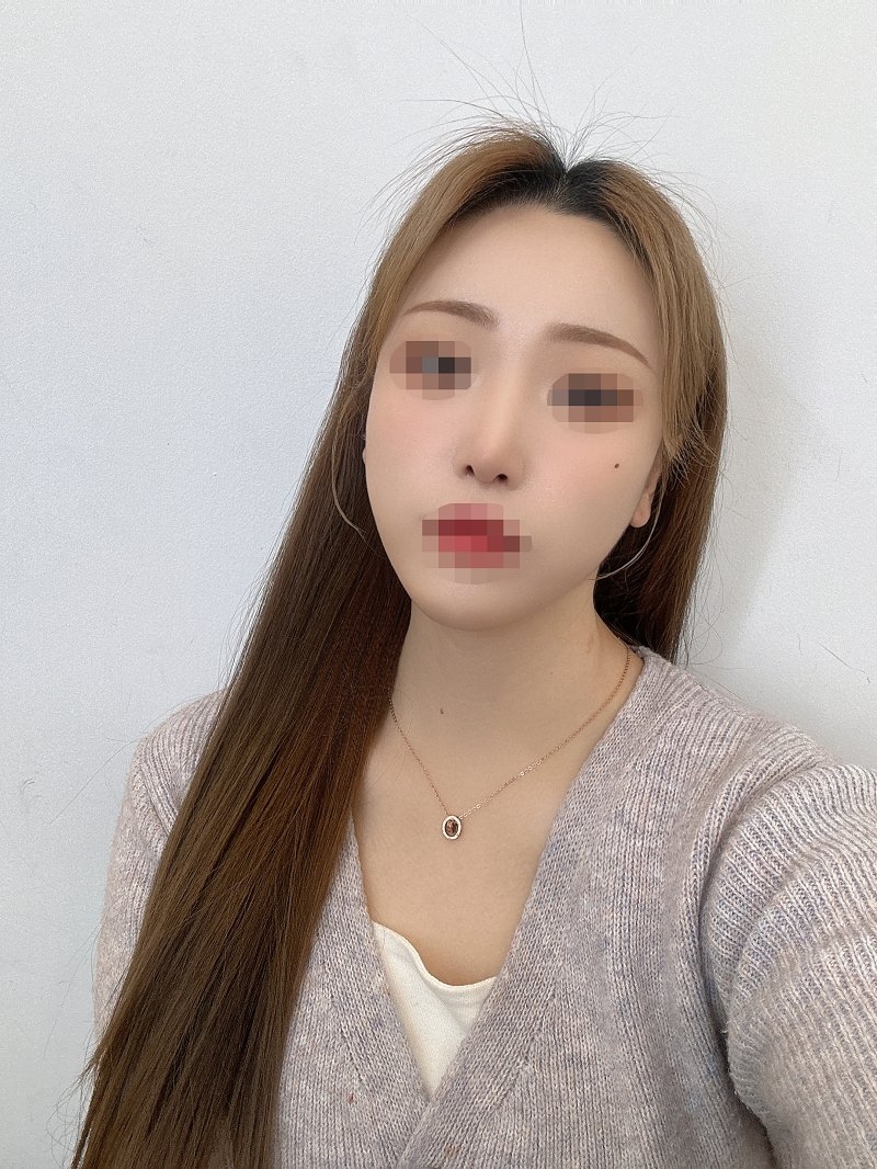 수술후기이미지