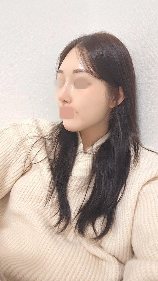 수술후기이미지