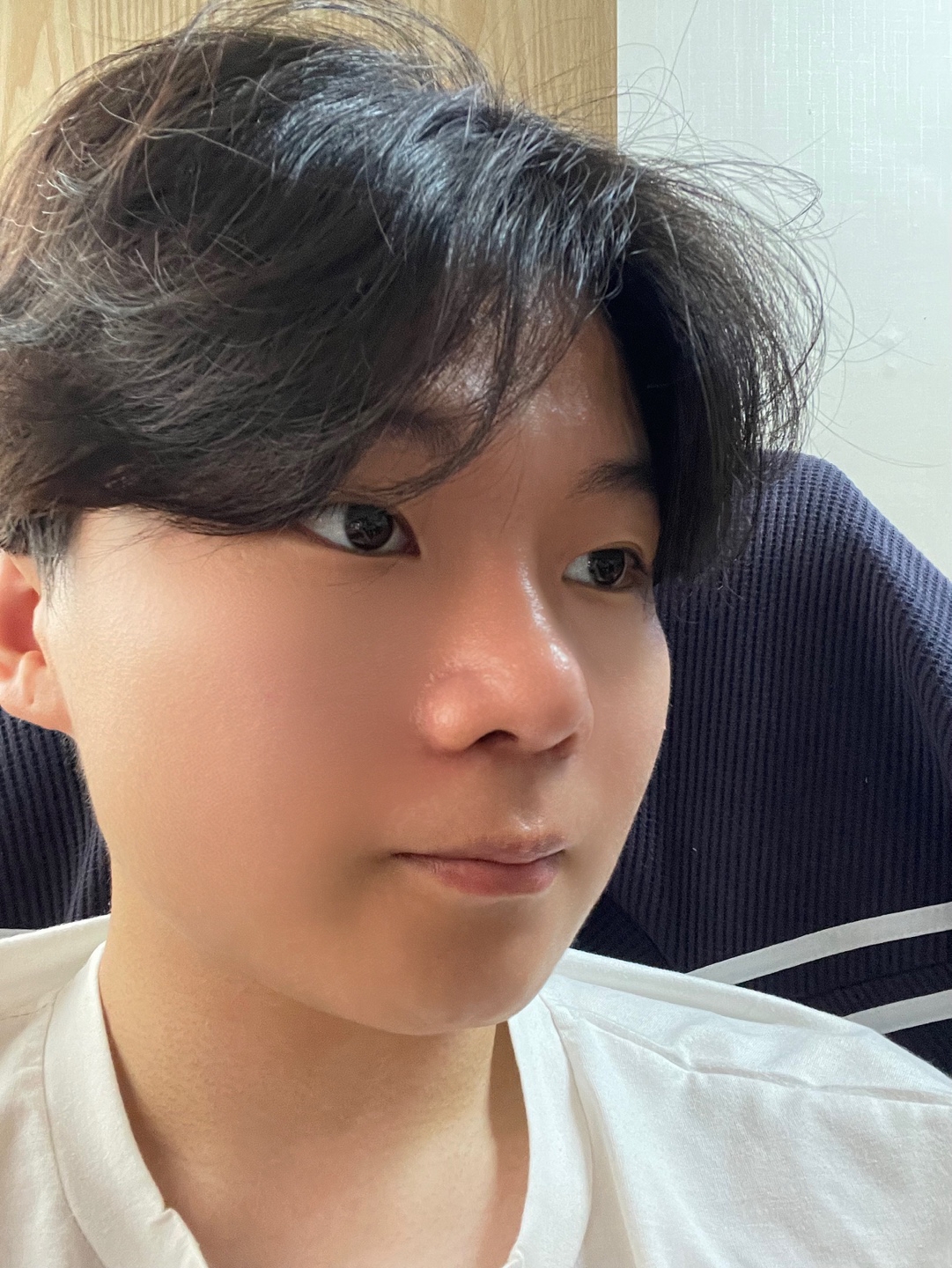 수술후기이미지