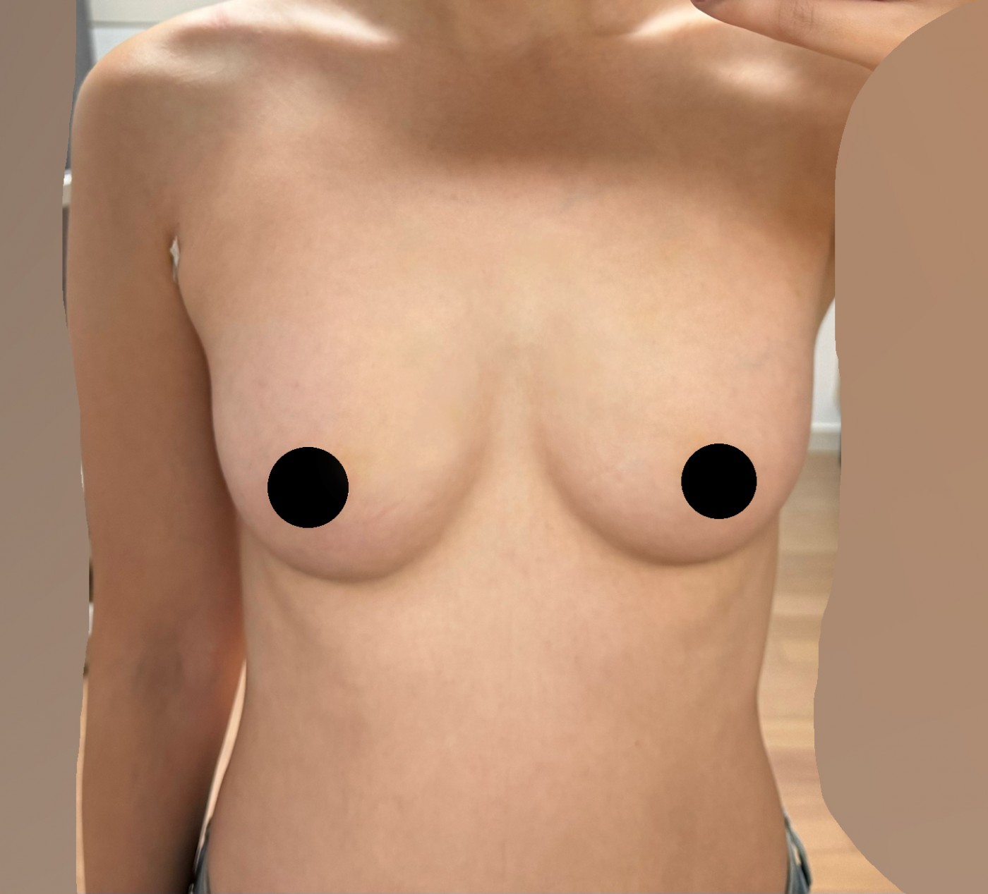 수술후기이미지