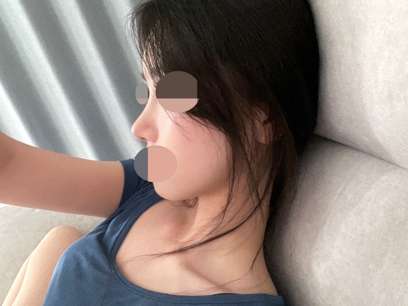 수술후기이미지