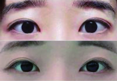 수술후기이미지