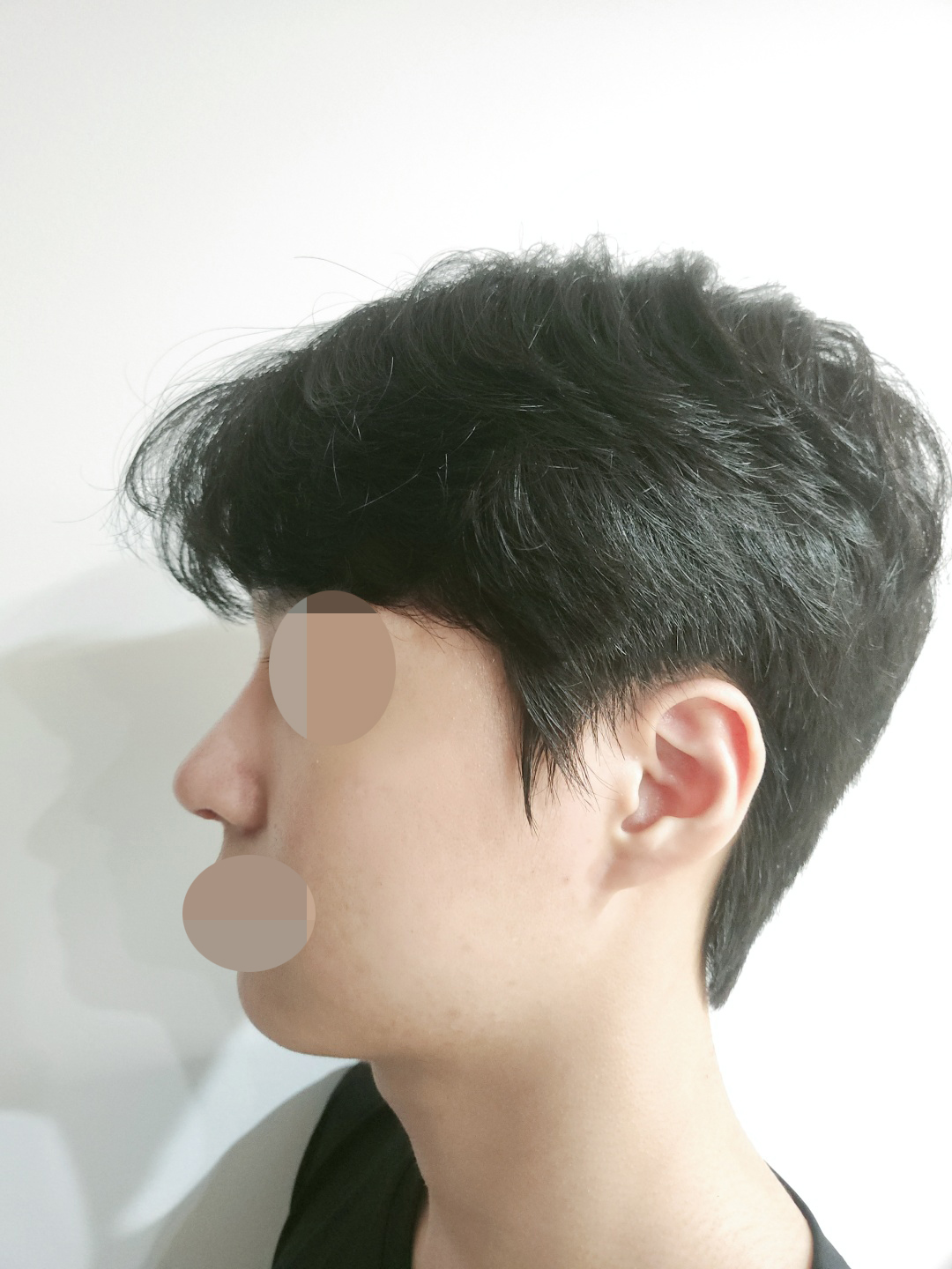 수술후기이미지