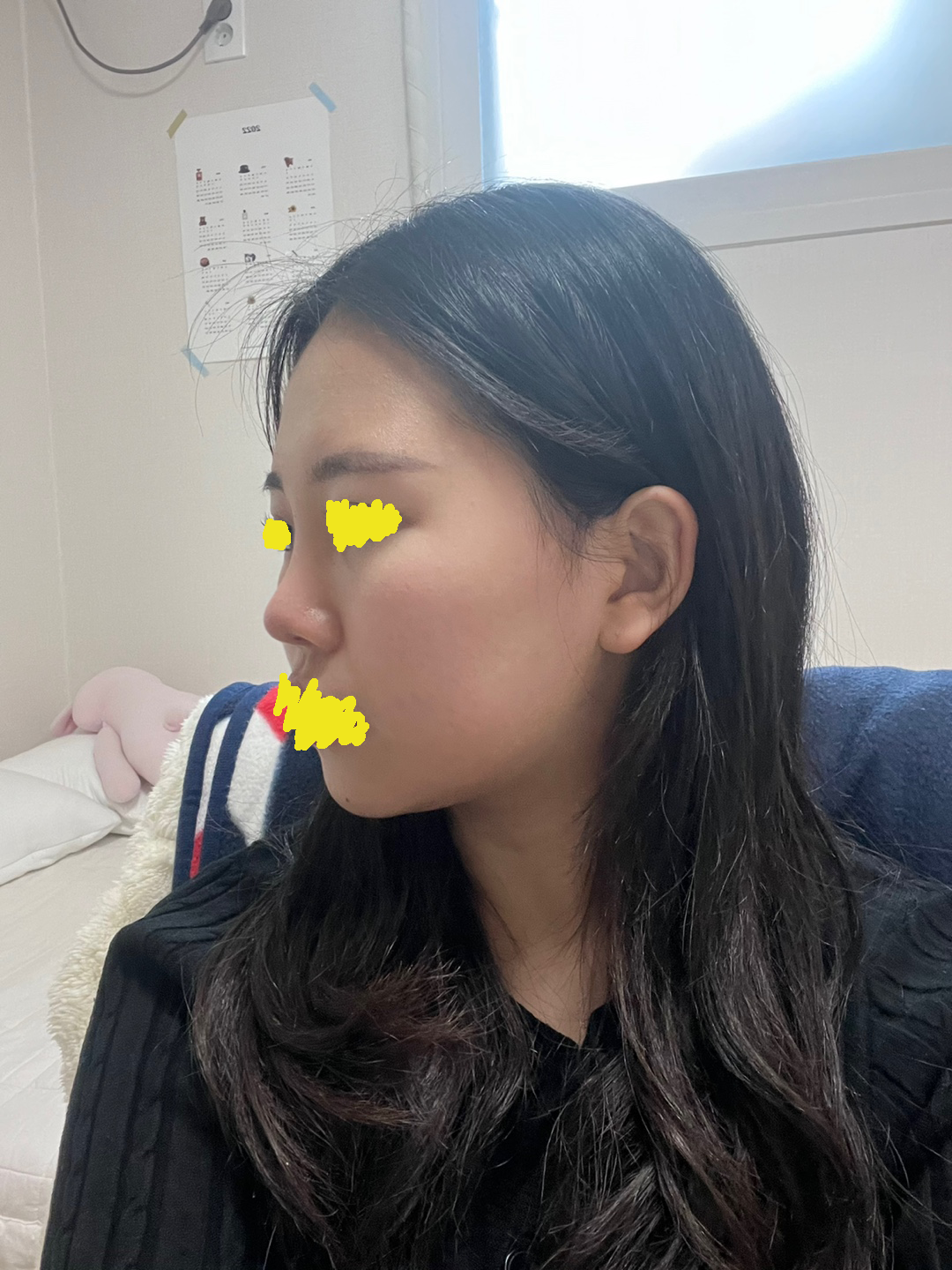 수술후기이미지