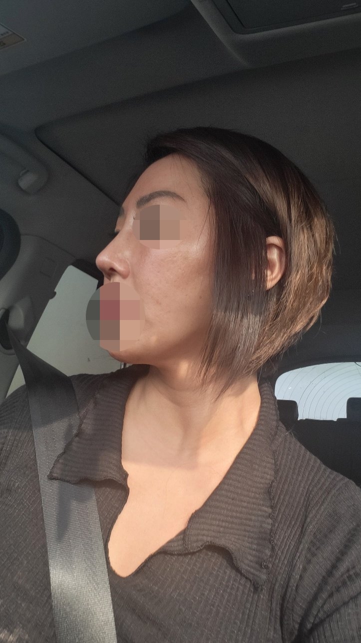 수술후기이미지