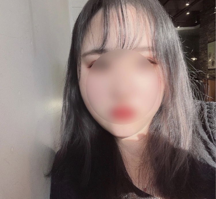 수술후기이미지