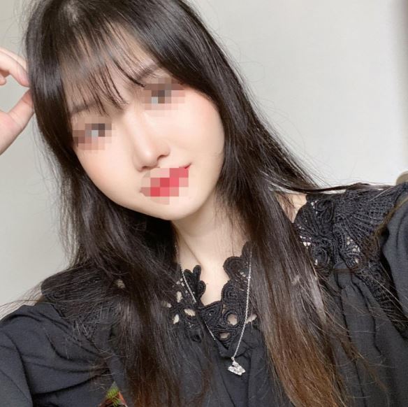 수술후기이미지