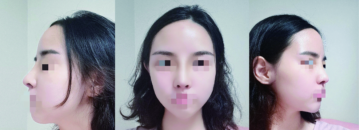 수술후기이미지