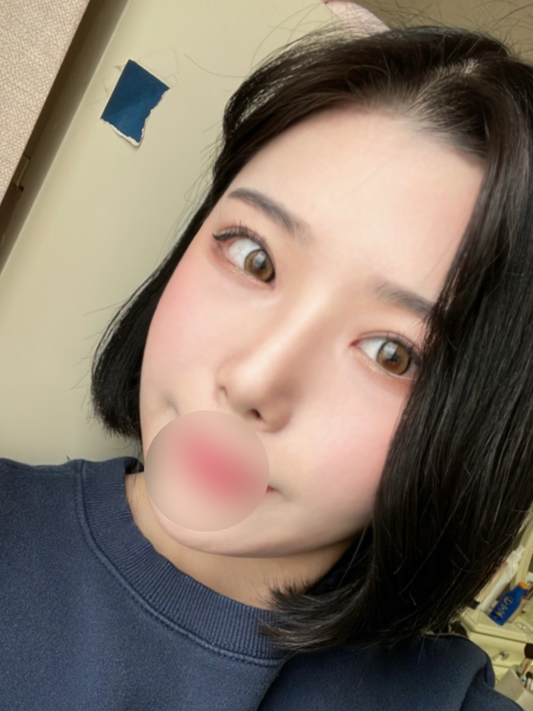 수술후기이미지