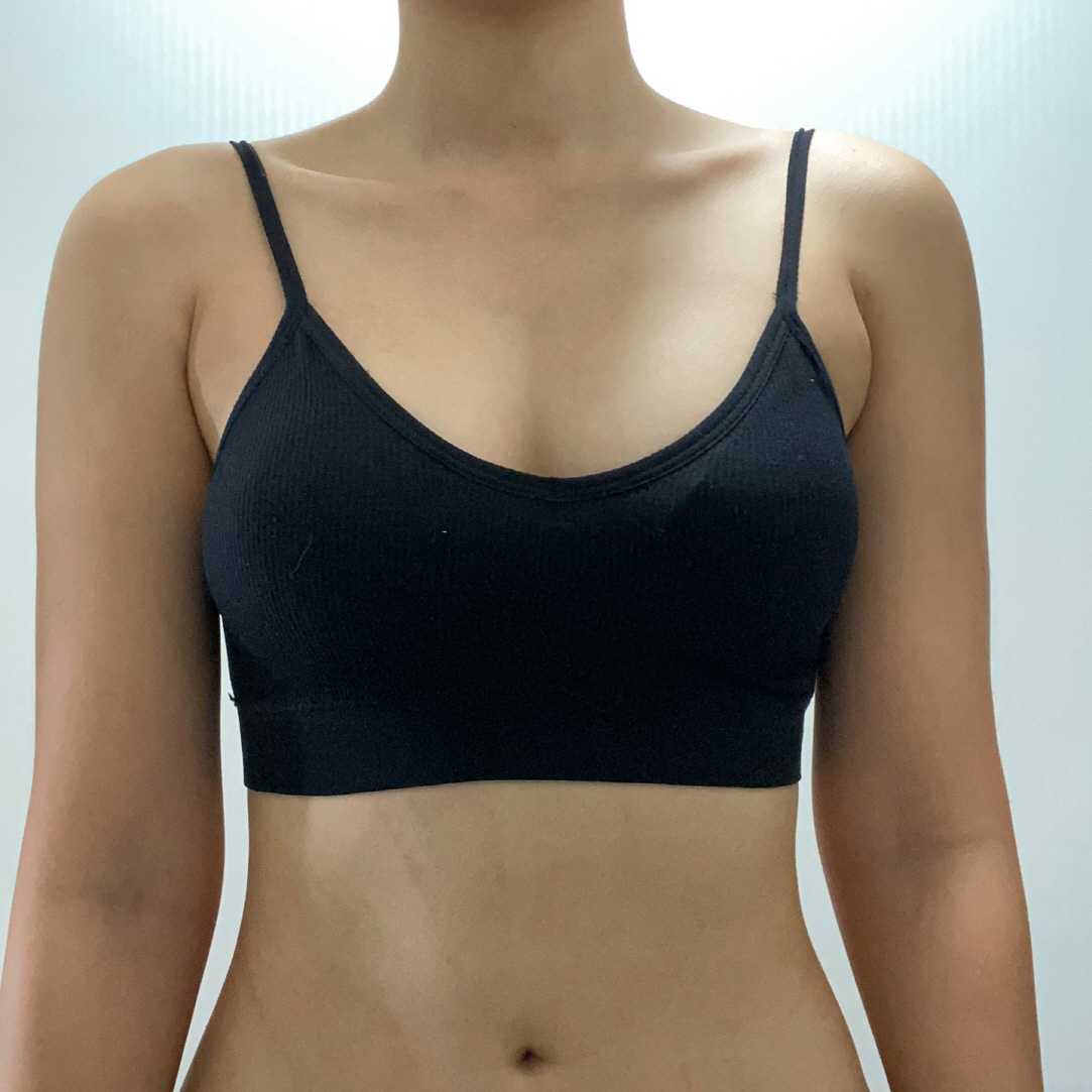 수술후기이미지