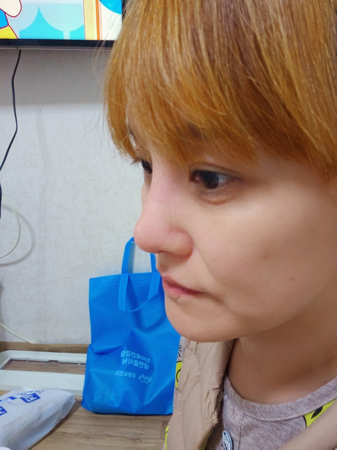 수술후기이미지