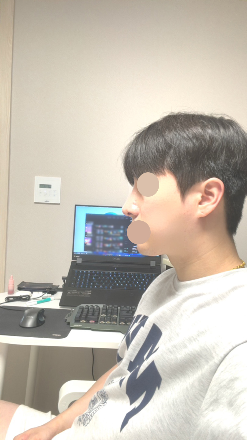 수술후기이미지