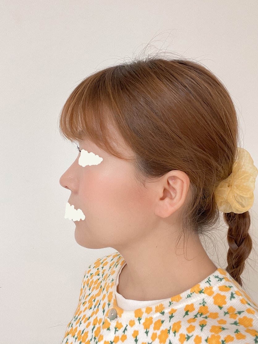 수술후기이미지