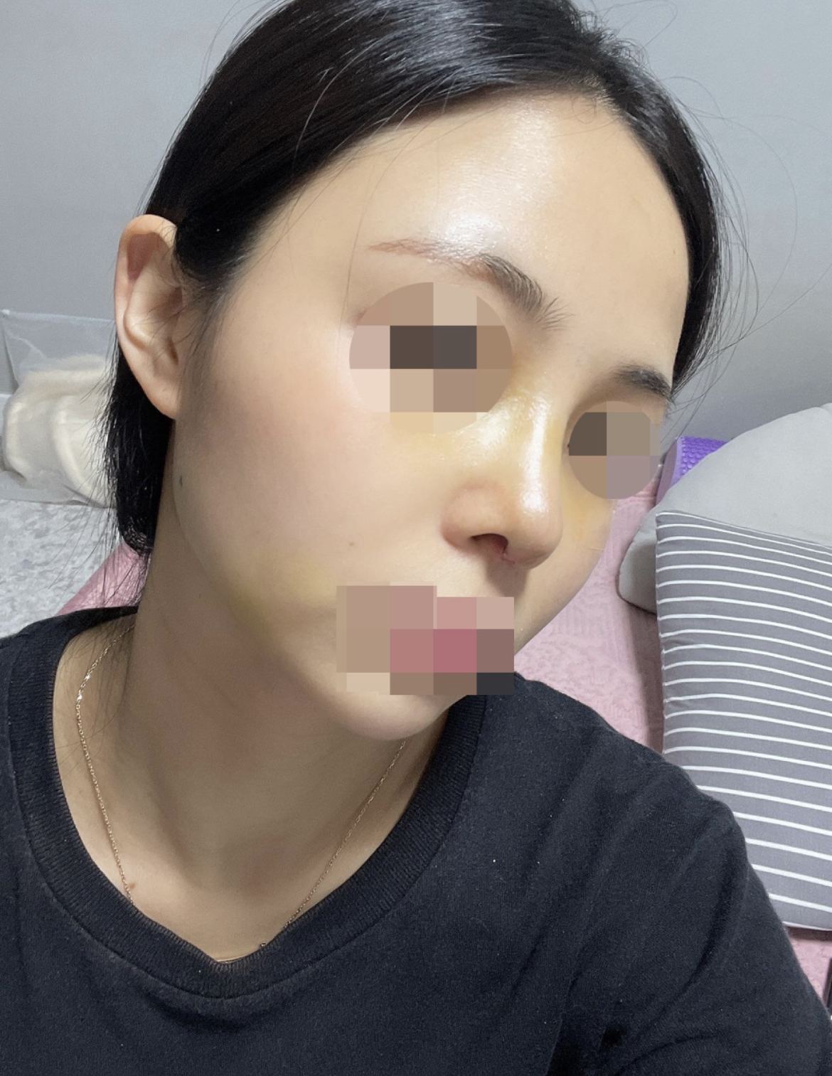 수술후기이미지