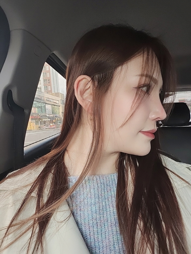 수술후기이미지