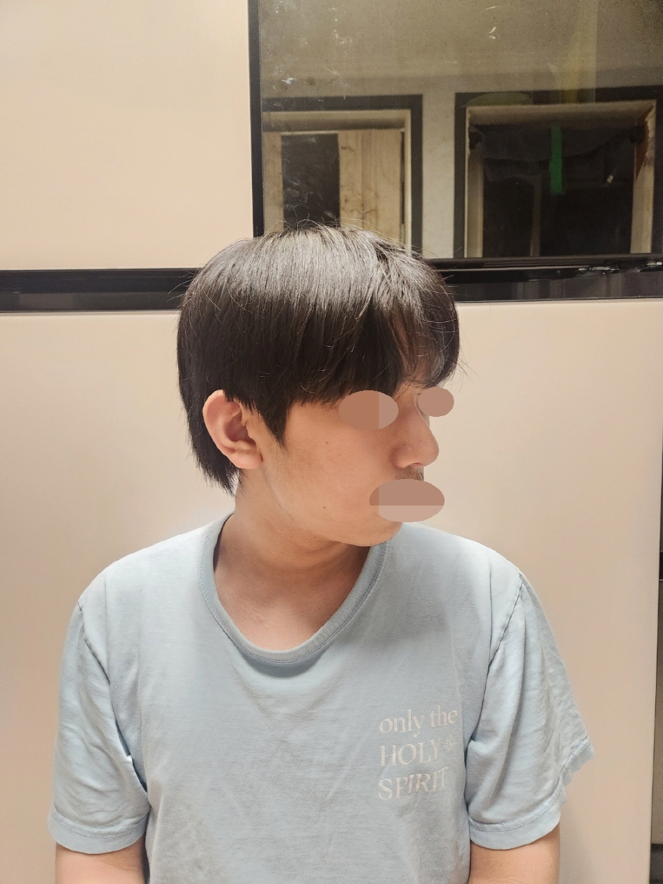 수술후기이미지