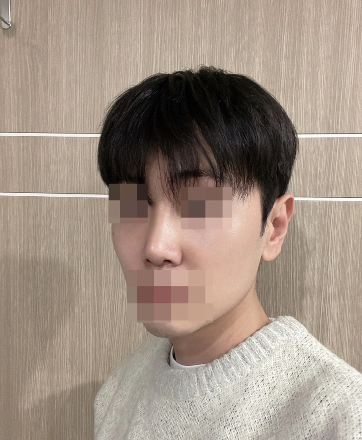 수술후기이미지