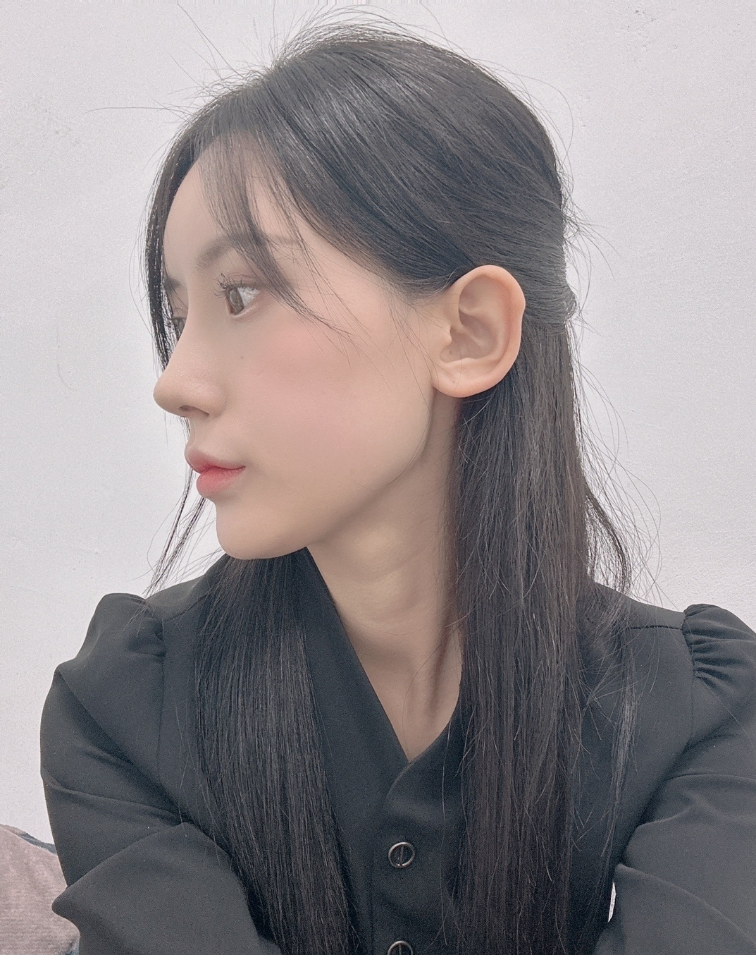 수술후기이미지