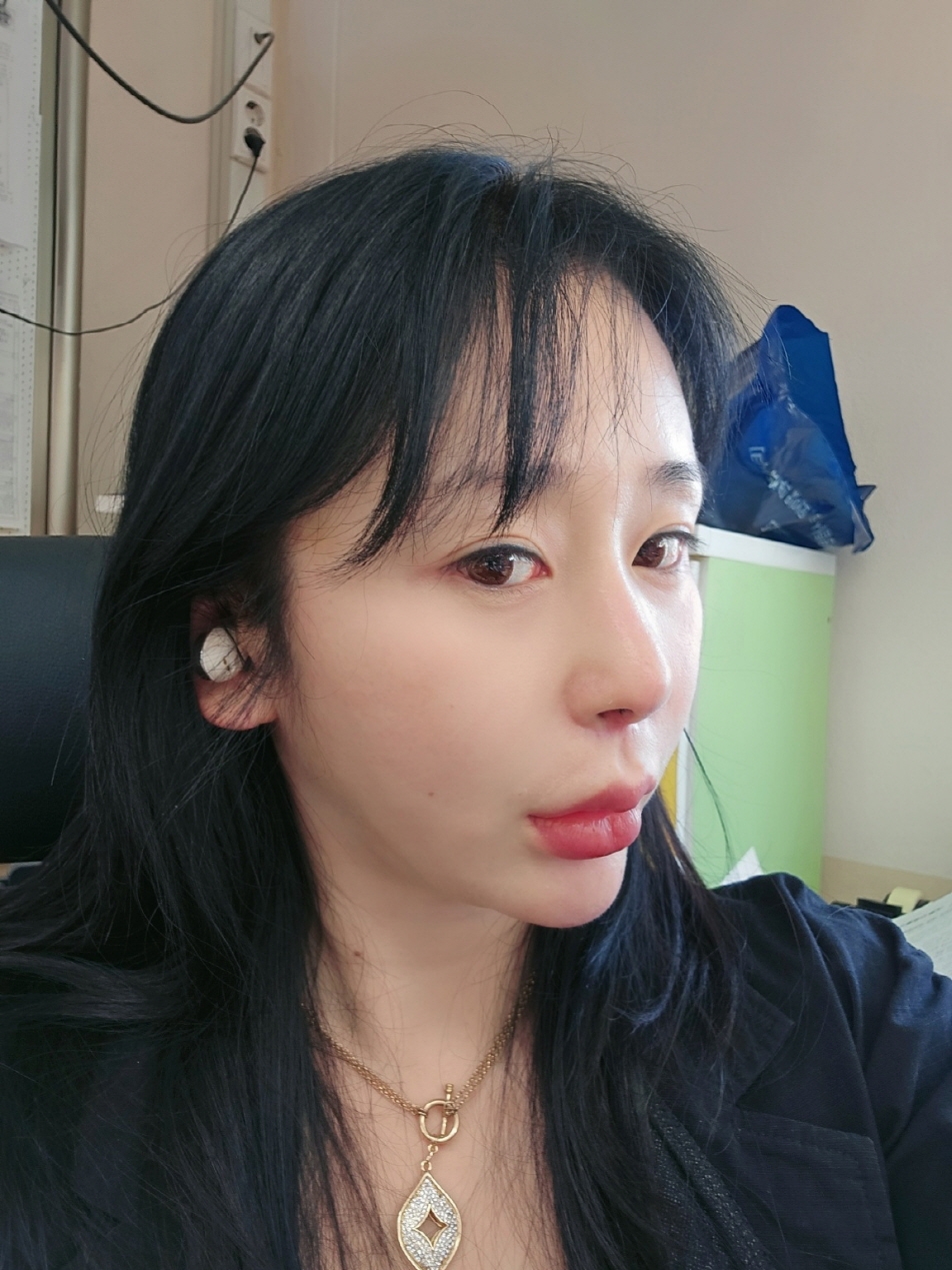 수술후기이미지