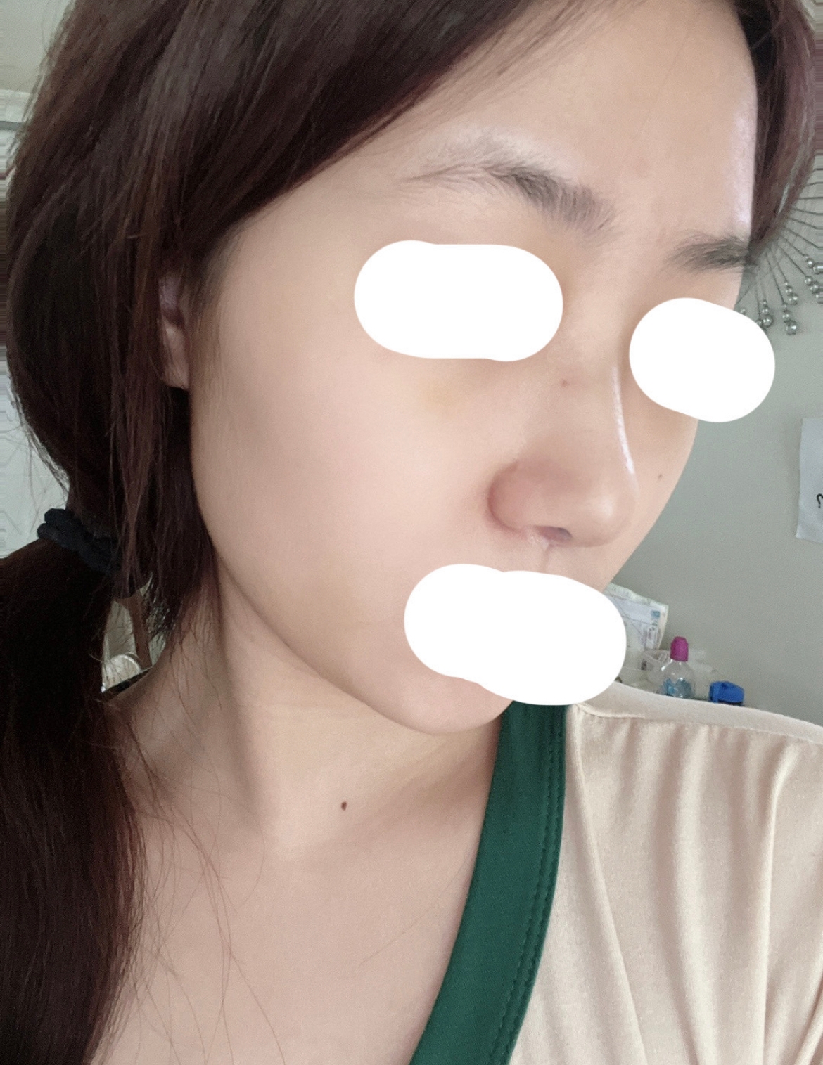 수술후기이미지