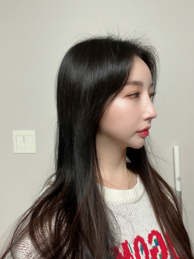 수술후기이미지