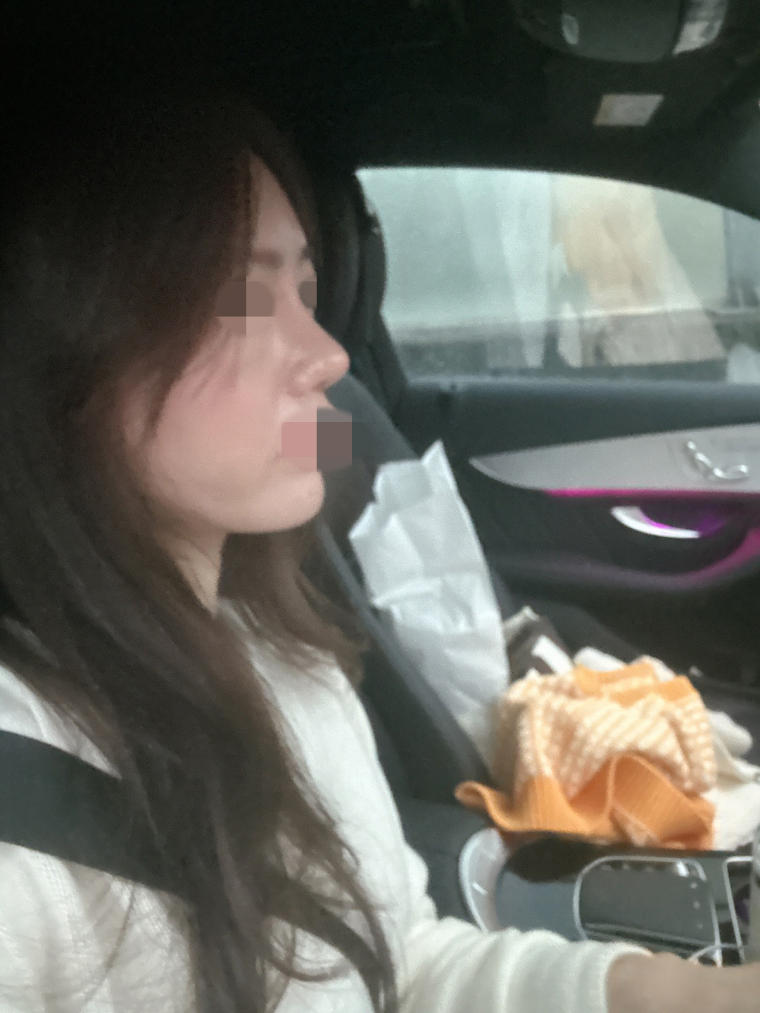 수술후기이미지