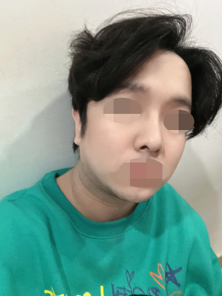 수술후기이미지