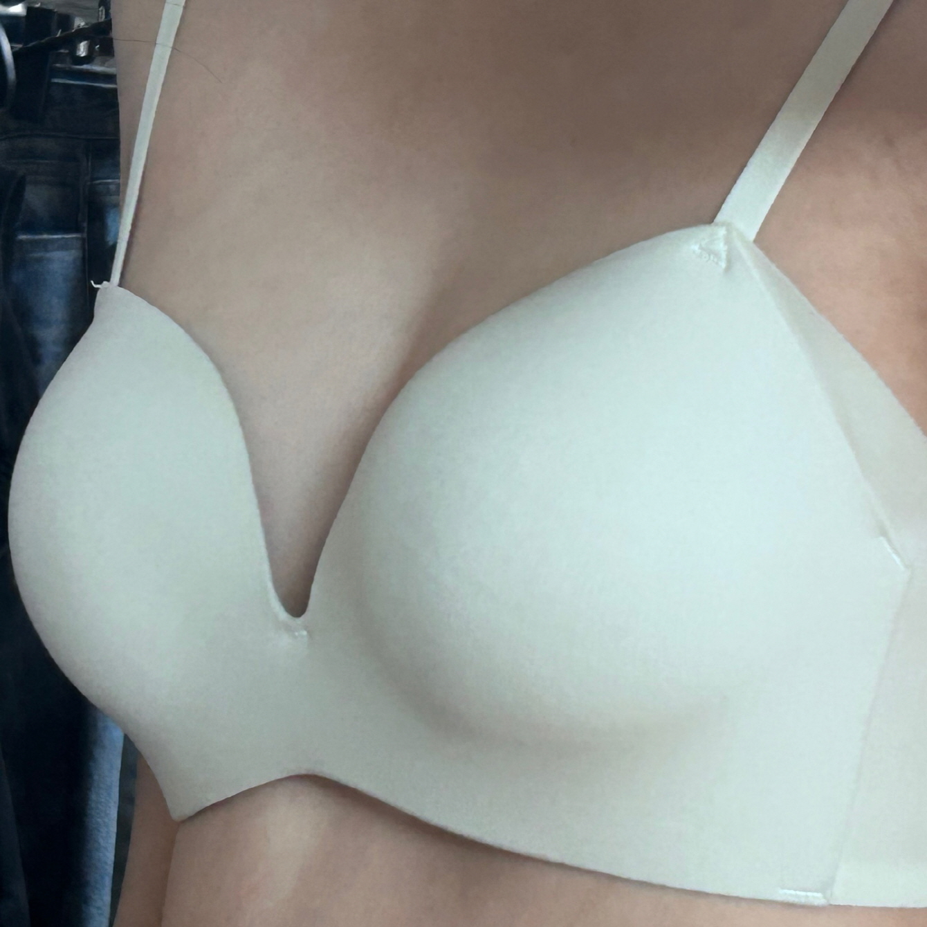 수술후기이미지