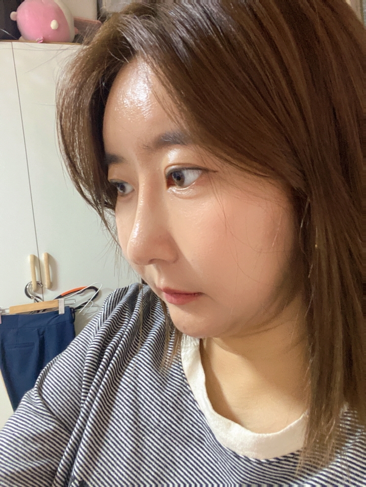 수술후기이미지