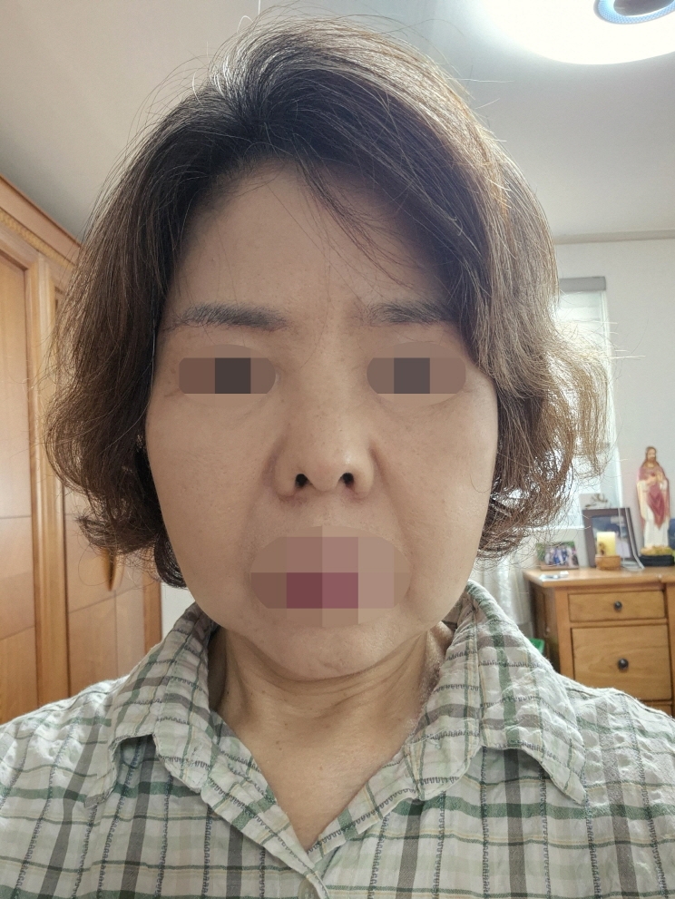 수술후기이미지