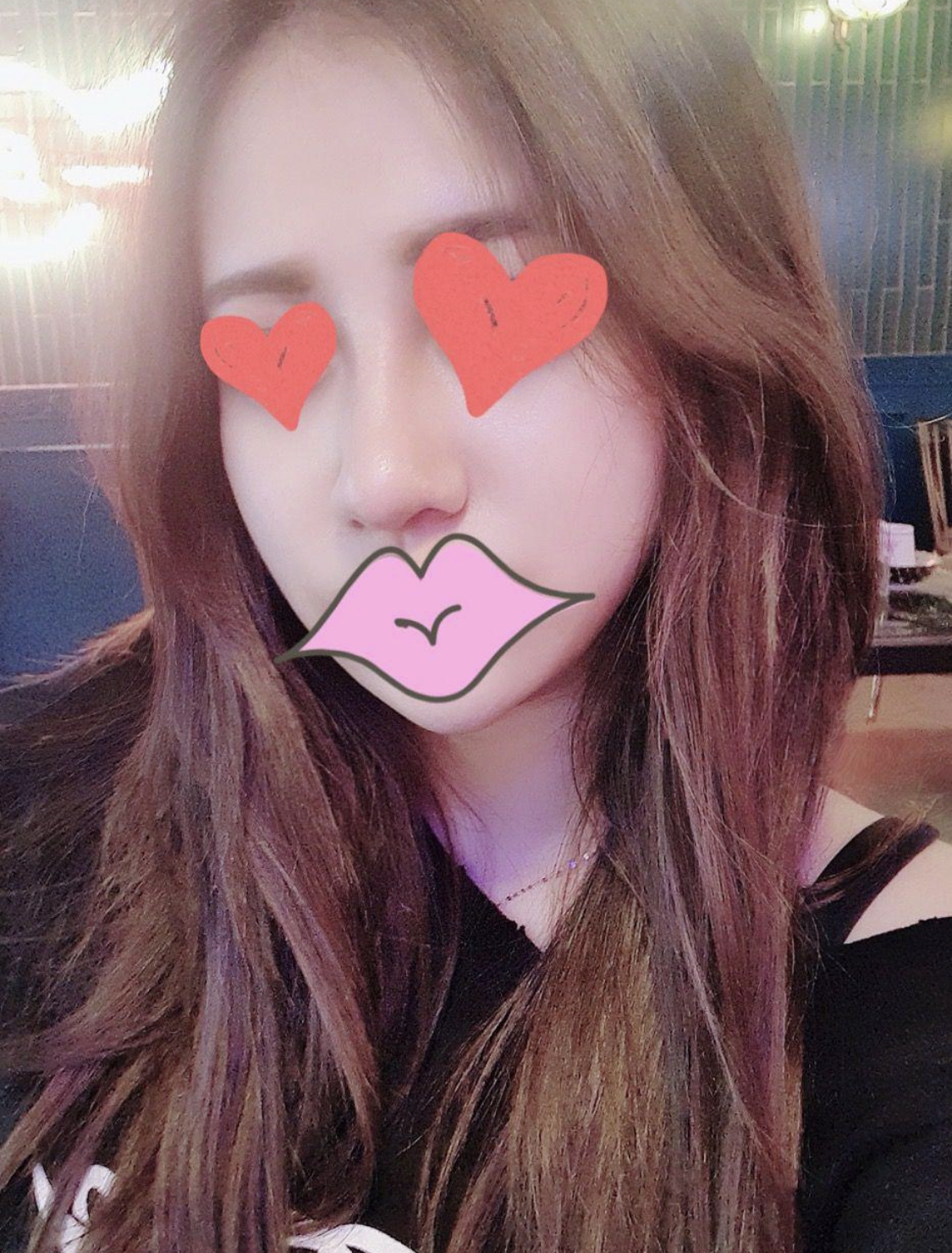 수술후기이미지