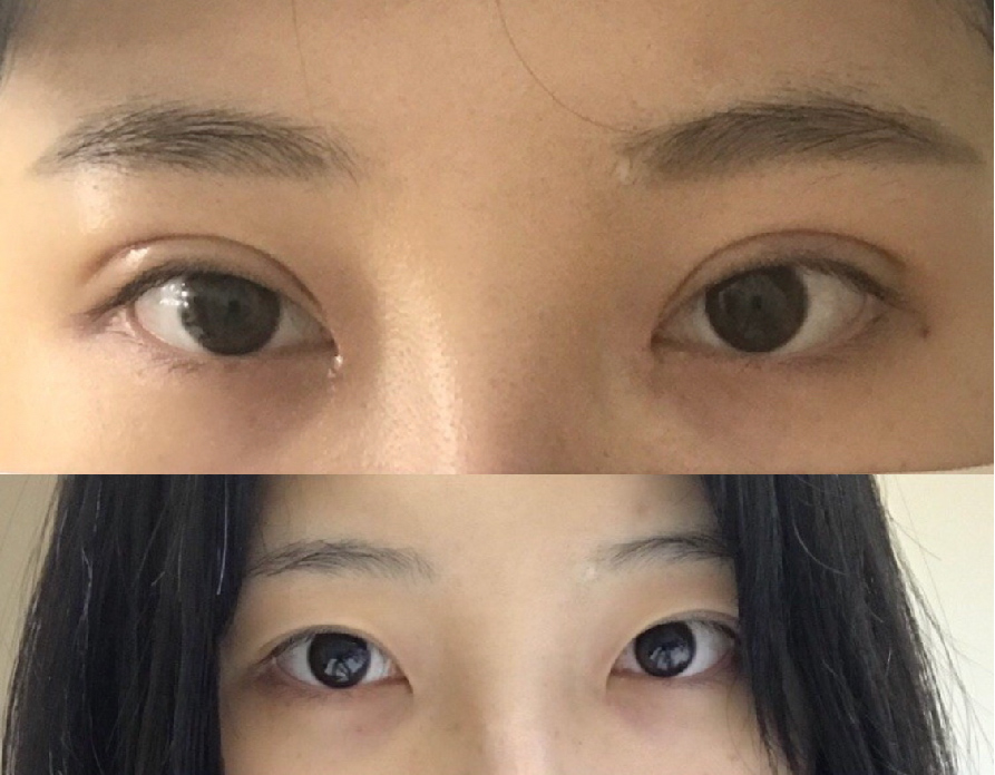 수술후기이미지