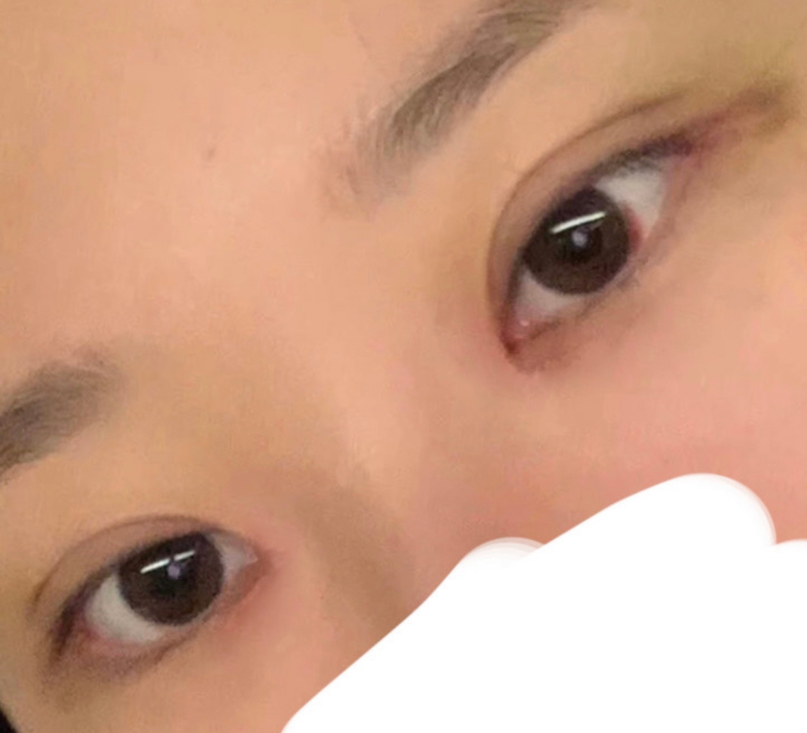 수술후기이미지